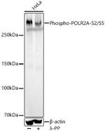 Phospho-RNA pol II CTD (Ser2, Ser5) Recombinant Rabbit Monoclonal Antibody (10W0C8)