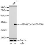 Phospho-STING (Ser366) Antibody in Western Blot (WB)