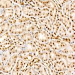 Phospho-AKT Pan (Thr450, Thr451, Thr447) Antibody in Immunohistochemistry (Paraffin) (IHC (P))