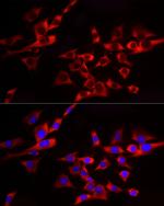 EIF4A1/EIF4A2/EIF4A3 Antibody in Immunocytochemistry (ICC/IF)