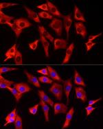 EIF4A1/EIF4A2/EIF4A3 Recombinant Rabbit Monoclonal Antibody (10P2J5)