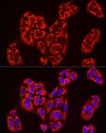 EIF4A1/EIF4A2/EIF4A3 Antibody in Immunocytochemistry (ICC/IF)