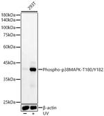 Phospho-p38 MAPK (Thr180, Tyr182) Recombinant Rabbit Monoclonal Antibody (4D0A9)