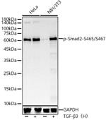 Phospho-SMAD2 (Ser465, Ser467) Antibody in Western Blot (WB)
