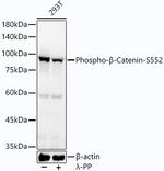 Phospho-beta Catenin (Ser552) Antibody in Western Blot (WB)