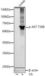 Phospho-AKT1 (Thr308) Recombinant Rabbit Monoclonal Antibody (0W7G3)