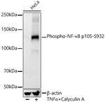 Phospho-NFkB p105 (Ser932) Antibody in Western Blot (WB)