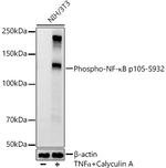Phospho-NFkB p105 (Ser932) Recombinant Rabbit Monoclonal Antibody (8B9G6)