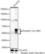 Phospho-Tau (Ser404) Antibody in Western Blot (WB)