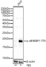 Phospho-4EBP1 (Thr70) Antibody in Western Blot (WB)