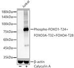 Phospho-FOXO1/FOXO3/FOXO4 (Thr24, Thr32, Thr28) Antibody in Western Blot (WB)