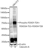 Phospho-FOXO1/FOXO3/FOXO4 (Thr24, Thr32, Thr28) Recombinant Rabbit Monoclonal Antibody (3V0U2)