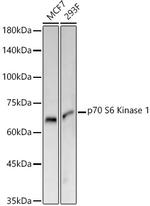 p70 S6 Kinase Recombinant Rabbit Monoclonal Antibody (4W5D5)