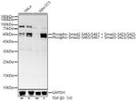 Phospho-SMAD2/SMAD3 (Ser465, Ser467, Ser423, Ser425) Recombinant Rabbit Monoclonal Antibody (6P1T1)