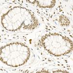 Phospho-CDK2 (Thr160) Antibody in Immunohistochemistry (Paraffin) (IHC (P))