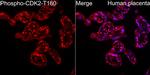 Phospho-CDK2 (Thr160) Antibody in Immunohistochemistry (Paraffin) (IHC (P))
