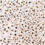Phospho-CDK2 (Thr160) Recombinant Rabbit Monoclonal Antibody (8W3U2)