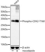 Phospho-CDK2 (Thr160) Antibody in Western Blot (WB)