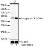 Phospho-CDK2 (Thr160) Antibody in Western Blot (WB)