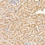 Phospho-HDAC4/HDAC5/HDAC9 (Ser246, Ser259, Ser220) Recombinant Rabbit Monoclonal Antibody (8H4J9)