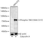 Phospho-TBK1 (Ser172) Recombinant Rabbit Monoclonal Antibody (5O6Y6)