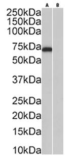 Softag 1 Chimeric Antibody in Western Blot (WB)