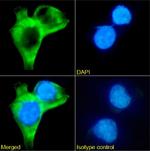 Tau Oligomeric Complex Chimeric Recombinant Rabbit Monoclonal Antibody (TOC1)