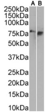 Tau Oligomeric Complex Chimeric Antibody in Western Blot (WB)