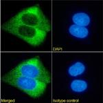 Ganglioside GM2 Chimeric Antibody in Immunocytochemistry (ICC/IF)