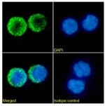 Tabalumab Chimeric Recombinant Rabbit Monoclonal Antibody (Tabalumab)