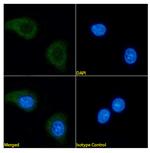 CD56 Chimeric Antibody in Immunocytochemistry (ICC/IF)