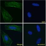 Nimotuzumab Chimeric Recombinant Rabbit Monoclonal Antibody (h-R3 (Nimotuzumab))