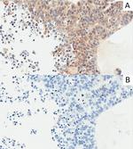 Carbonic Anhydrase IX Chimeric Recombinant Mouse Monoclonal Antibody (M75)