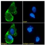 PD-L1 (CD274) Chimeric Recombinant Rabbit Monoclonal Antibody (332M7)