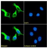 SLC6A4 Chimeric Recombinant Rabbit Monoclonal Antibody (8B6)