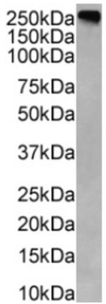 CEA Chimeric Antibody in Western Blot (WB)