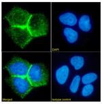 CEA Chimeric Recombinant Rabbit Monoclonal Antibody (BW431/26)