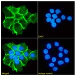EGFR (Zalutumumab Biosimilar) Recombinant Rabbit Monoclonal Antibody (2F8 (Zalutumumab; HuMax-EGFR))