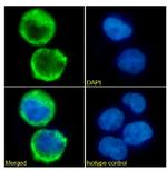 CD52 Chimeric Recombinant Rabbit Monoclonal Antibody (CF1D12)