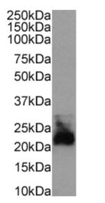 CD52 Chimeric Antibody in Western Blot (WB)
