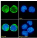 CD52 Chimeric Recombinant Rabbit Monoclonal Antibody (HI186)
