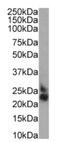 CD52 Chimeric Antibody in Western Blot (WB)