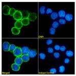 CD47 Chimeric Recombinant Rabbit Monoclonal Antibody (2D14)