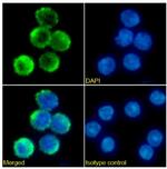 CD40 Chimeric Antibody in Immunocytochemistry (ICC/IF)