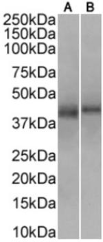 CD34 Chimeric Antibody in Western Blot (WB)