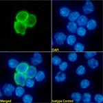 CD25 Chimeric Antibody in Immunocytochemistry (ICC/IF)