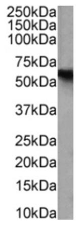 CD25 Chimeric Antibody in Western Blot (WB)