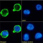 CD20 Chimeric Recombinant Rabbit Monoclonal Antibody (B9E9)