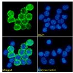 CD163 Chimeric Recombinant Rabbit Monoclonal Antibody (2A10 (2A10/11))