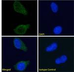 Tau Antibody in Immunocytochemistry (ICC/IF)